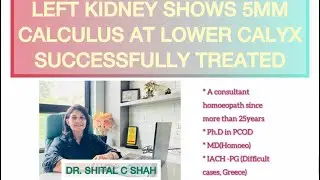 Kidney Stone Successfully Treated at Acute Homoeo Clinic | Dr. Shital C. Shah | 7mm-9mm & 5mm Stones