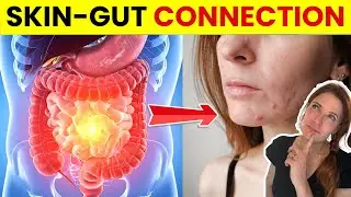 The Gut–Skin Axis Explained: How Your Diet Impacts Acne, Rosacea & Inflammation