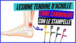 LESIONE AL TENDINE D'ACHILLE come camminare con le stampelle