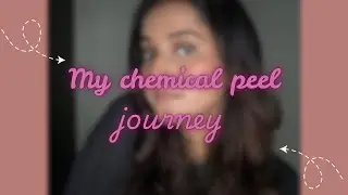My first time getting a chemical peel!!