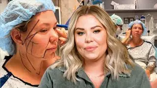 KAIL LOWRY SHOCKS FANS WITH SURGERY PHOTOS! SECRET FACELIFT?!?