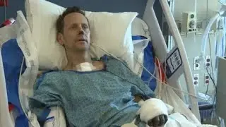 Boulder man undergoes amputations after flu ultimately leads to life-threatening sepsis