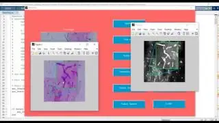Segmentation Splitting and Classification of Overlapping Bacteria in Microscope Image matlab project