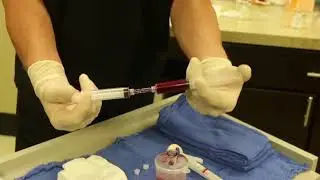 Amniotic Stem Cell Procedure