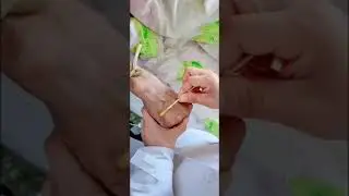 Injection Fear Funny Videos ~ scared of injection 💉💉 Injection Control By Doctor 红 health Care #60