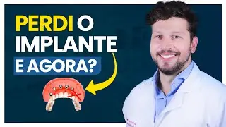 O Implante Dentário CAIU e Agora o que Fazer?