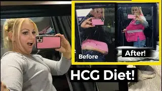 Hcg Diet Before And After