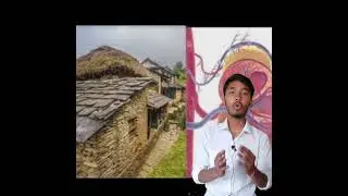 kidney valley #short