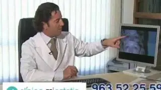 Blefaroplastia estética