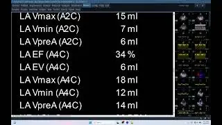 IQ 411 ECHOCARDIOGRAPHY ECHOPAC ANALYSIS LUNG TUMOUR REPORT, SMALL ANIMAL DOG