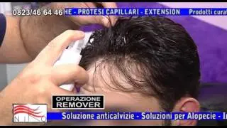 0823 466446 prezzi e costi protesi capelli veri Napoli, Caserta- calvizia