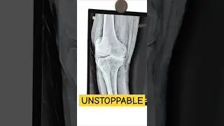 Best Orthopaedic surgeon Moradabad in 2025 #best #orthopedicsurgeon #moradabad #2025 #doctor #mbbs
