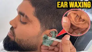Ear Waxing Removal: Safe DIY Tips & Professional Tricks
