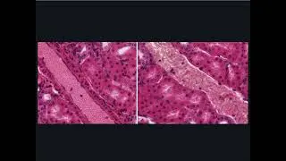 Cardiovascular Histology - Smaller Arteriole and Venule
