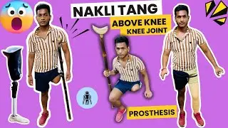 😱Above Knee Prosthesis | घुटने के ऊपर का कृत्रिम अंग | Carbon Foot | #ossur  #abovekneeprosthesis