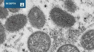 Spain reports first monkeypox-related death in Europe