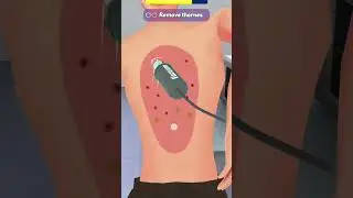 doctor treatment ll #game#cartoon#video#baby#doctor#treatment