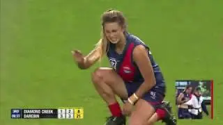Chloe Molloy Shoulder Injury - VFLW Grand Final 2017