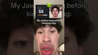 MY INSANE 2 YEAR JAWLINE TRANSFORMATION  #looksmax #looksmaxxing #mewing #tylerbtopg #umax