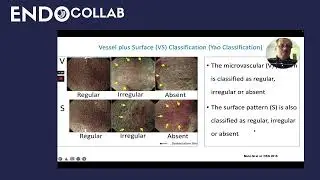 Endoscopic Characterization: A Closer Look at the VS Classification