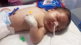 HIE Baby in NICU: Poor Reflexes, Poor Suck, Nasogastric Feeding