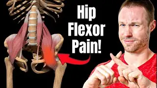 Why Your Hip Flexors Hurt (And How To Fix It Forever)