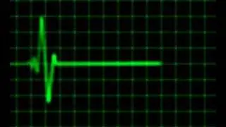 Animated heart rate monitor - electrocardiogram