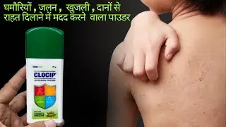 Clocip Powder | Clotrimazole Absorbent Dusting Powder Uses In Hindi | Clocip Antifungal Powder Uses