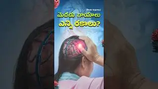 5 Types of Brain Injuries You Need to Know About