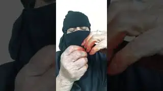 سالفة ام كعلة