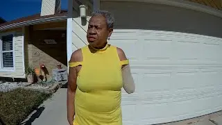 Video: Dog attack victim: Life ‘forever changed’ after arm severed during vicious pit bull attack
