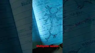 diagram of multipolar neuron 😇