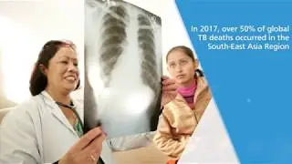 Accelerate efforts to End-Tuberculosis by 2030