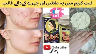 Tibet Cream Acne Treatment and Fairness Formula | Get Glowing and Clear Skin