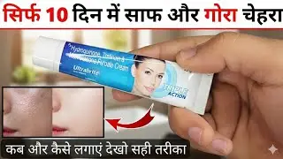 Ultrabrite Cream for Skin Whitening & Brightening | Dark Spot Removal | All Skin Types 