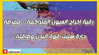 رقية إخراج العيون المتراكمة - أمرضت وسلبت طاقة البدن وقوته . الشيخ عبدالرحمن الموصلي