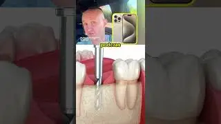 Dlaczego Implanty Są Takie... TANIE 😳😱