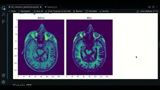 2.0 - Denoise & morphological operations | ANTsPy - Course MRI preprocessing with Python
