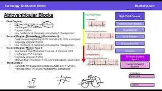 Lecture-31-CVS -AV Blocks (Medlearna Bootcamp-Usmle course)- In simple pashto