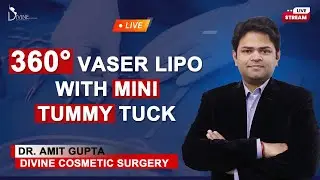 360 Vaser Lipo With Mini Tummy Tuck, 1st Step - Back Lipo