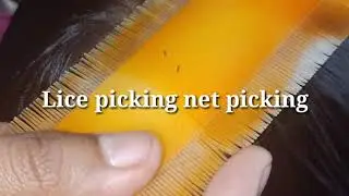 Lice picking net picking// net picking  by hand// net picking  by fingers