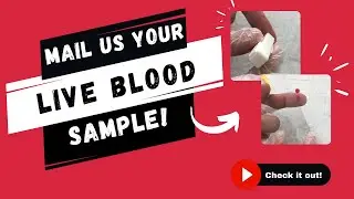 Shipping a Live Blood Sample