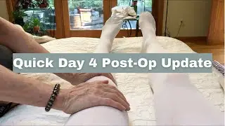 Day 4 Post-Op Update || My Labral Tear/FAI Surgery Recovery as a Dancer