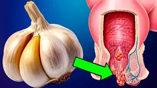 Eat garlic, but never make this fatal mistake (Only 1% know the dangers of garlic) | 484