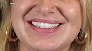 Dental Treatment in Turkey 🇹🇷 | Affordable & High Quality