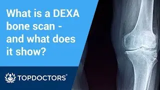 What is a DEXA bone scan and what does it show?