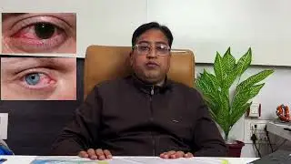 Chitrakoot Eye Hospital: World-Class Care for Your Vision | Dr. Ashotosh Rai Explains