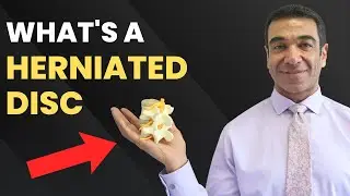 What is a Herniated Disc? - Frederick Chiropractor