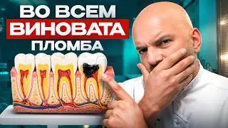 Как поставить ПЛОМБУ и не платить ДВАЖДЫ? Ошибки, которые стоят вам ДЕНЕГ