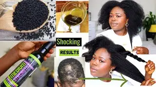 4 Ways to Use Pure Black Seed Oil For Massive hair Growth and For over all Health